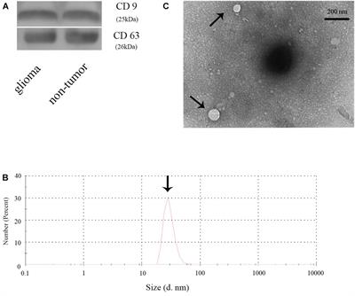 Exosomal miR-2276-5p in Plasma Is a Potential Diagnostic and Prognostic Biomarker in Glioma